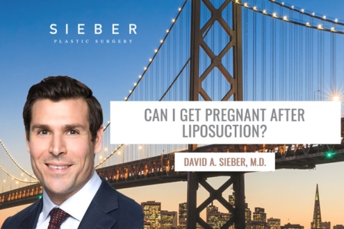 CAN I GET PREGNANT AFTER LIPOSUCTION