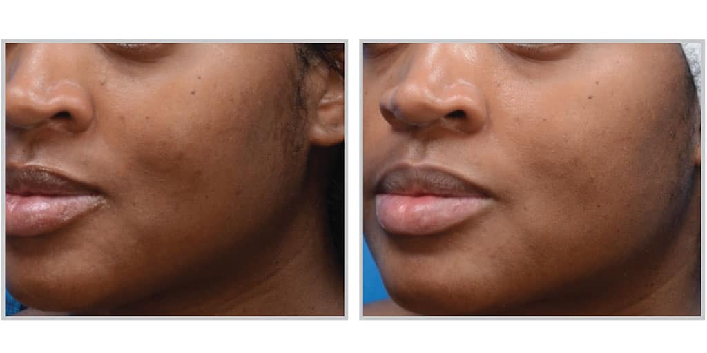 Moxi Before & After