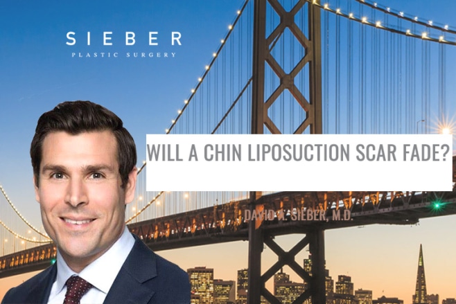 Will a Chin Liposuction Scar Fade