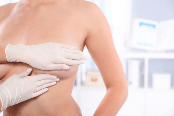 3D Breast Augmentation