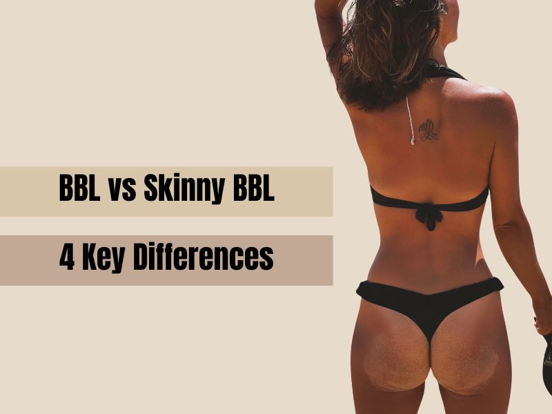 BBL vs Skinny BBL (Petite BBL)_ 4 Key Differences