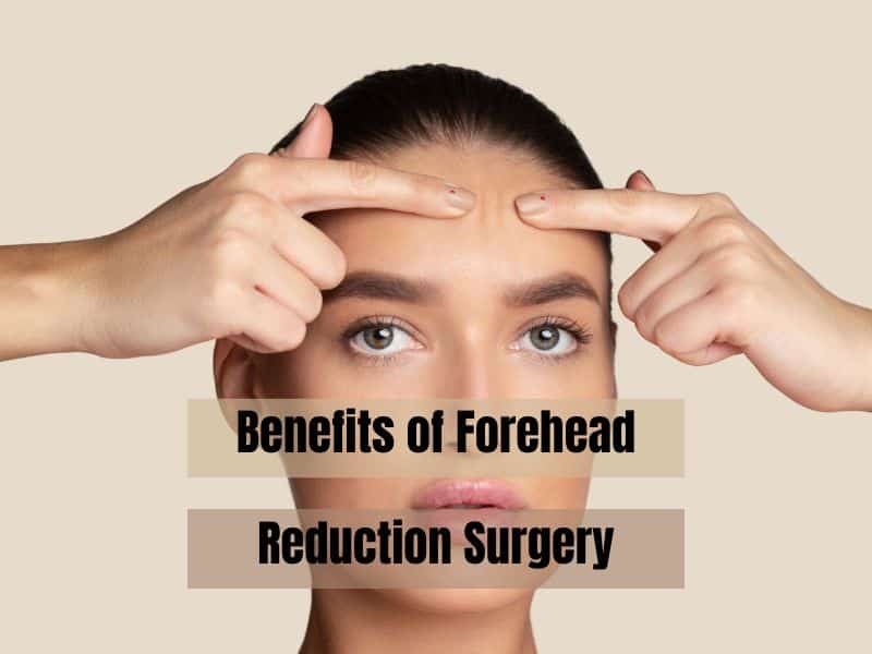 Benefits of Forehead Reduction Surgery