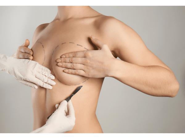 Breast Lift Incision Opening