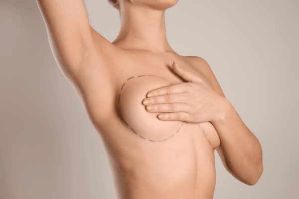 Breast Lift With Implants Recovery Time