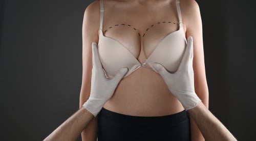 Breast Lift vs Implants