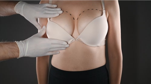 Breast augmentation appointment guide