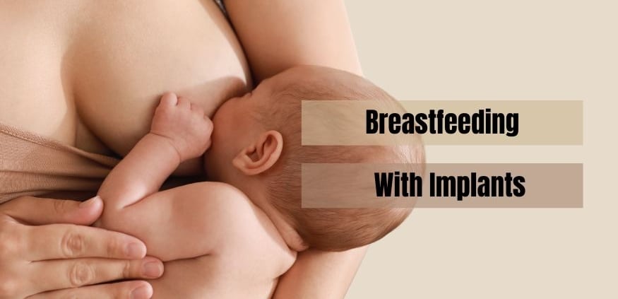 Breastfeeding With Implants