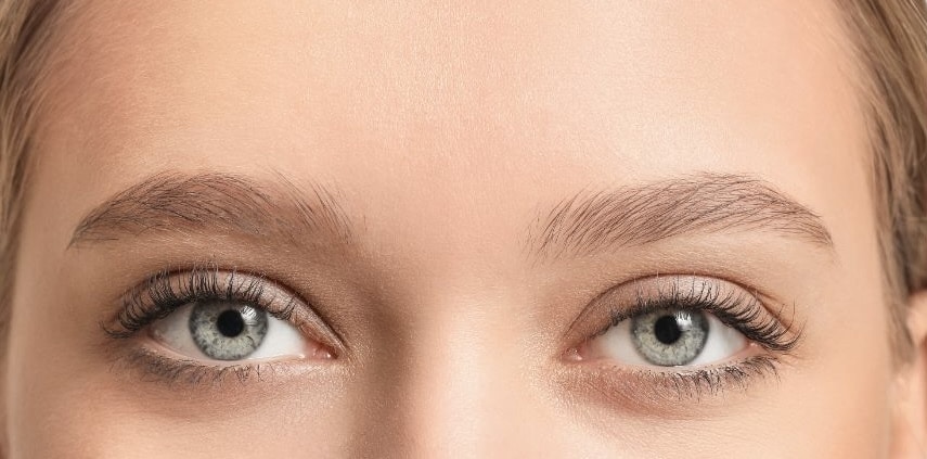 Brow Lift Before and After