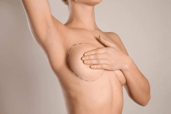 Can You Put Neosporin On Breast Implant Incisions