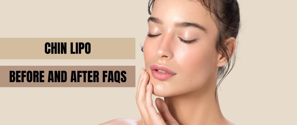 Chin Lipo Before and After FAQs