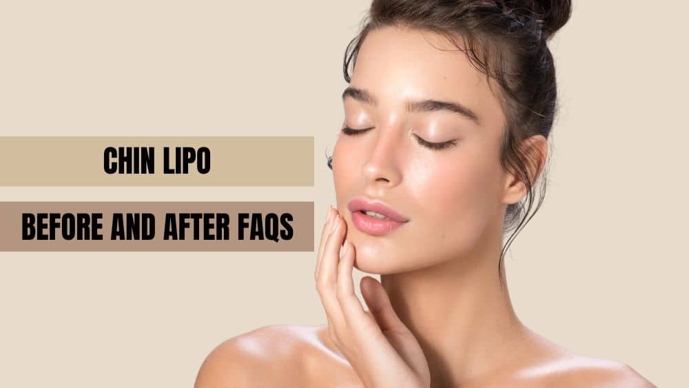 Chin Lipo Before and After FAQs