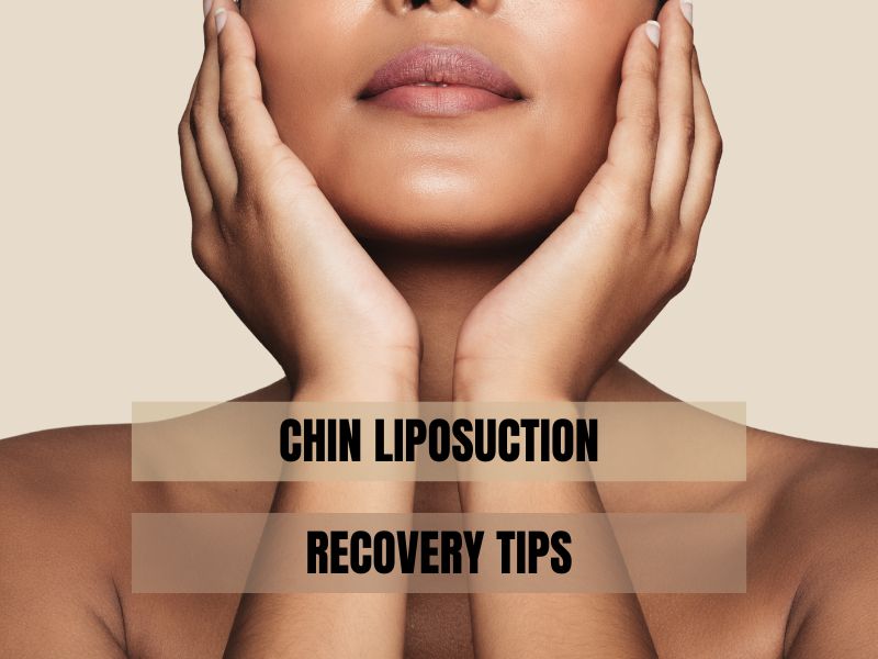 Chin Liposuction Recovery Tips