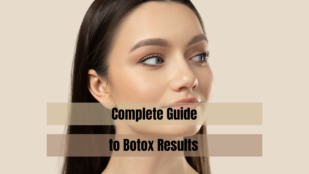 Complete Guide to Botox Results