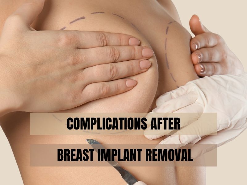 Complications After Breast Implant Removal