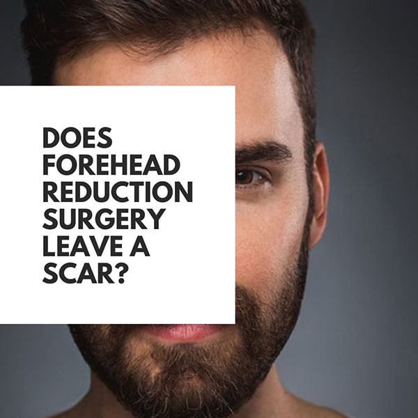 Does Forehead Reduction Surgery Leave a Scar