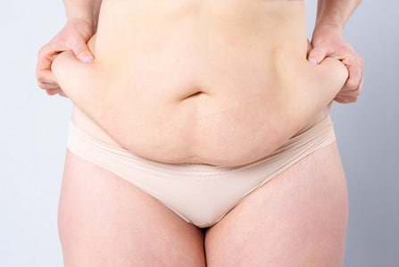 Drainless tummy tuck doctors