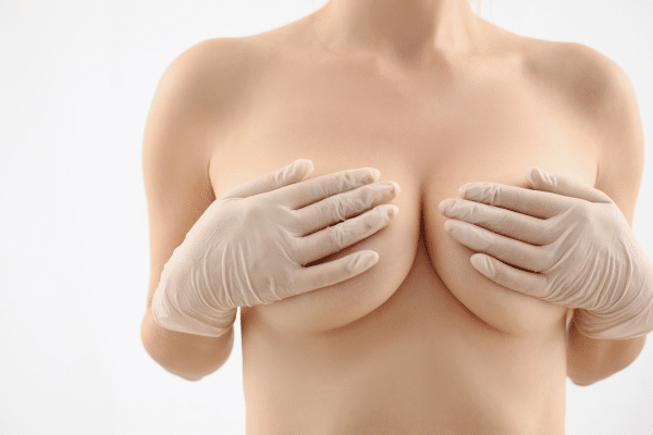 Fat Transfer Breast Augmentation Before And After Realself