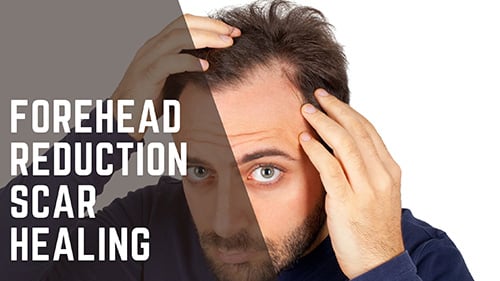 Forehead Reduction Scar Healing