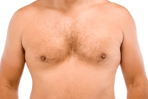 How Much Does Gynecomastia Surgery Cost