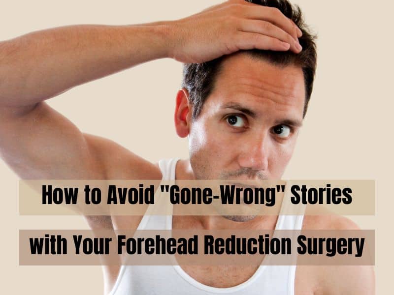 How to Avoid Mistakes and Gone-Wrong Stories with Your Forehead Reduction Surgery
