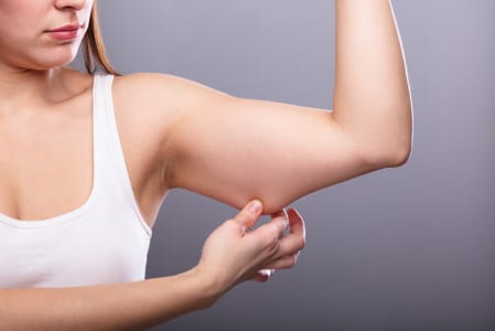 Liposuction on arms