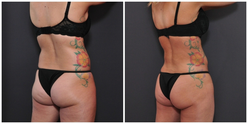 PicMonkey-Collage-1559-scaled-1-2048x1024