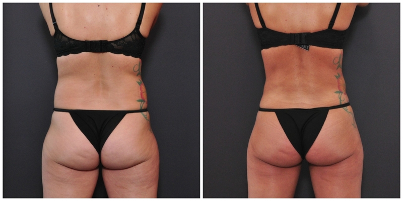 PicMonkey-Collage-1560-scaled-1-2048x1024