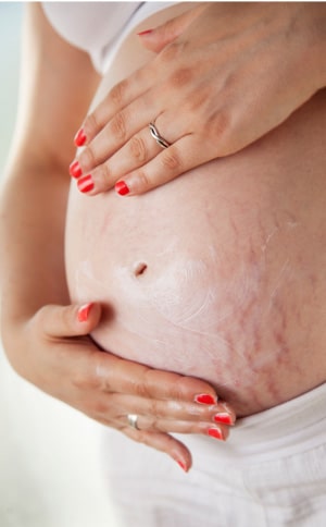 Recovery time for mommy makeover