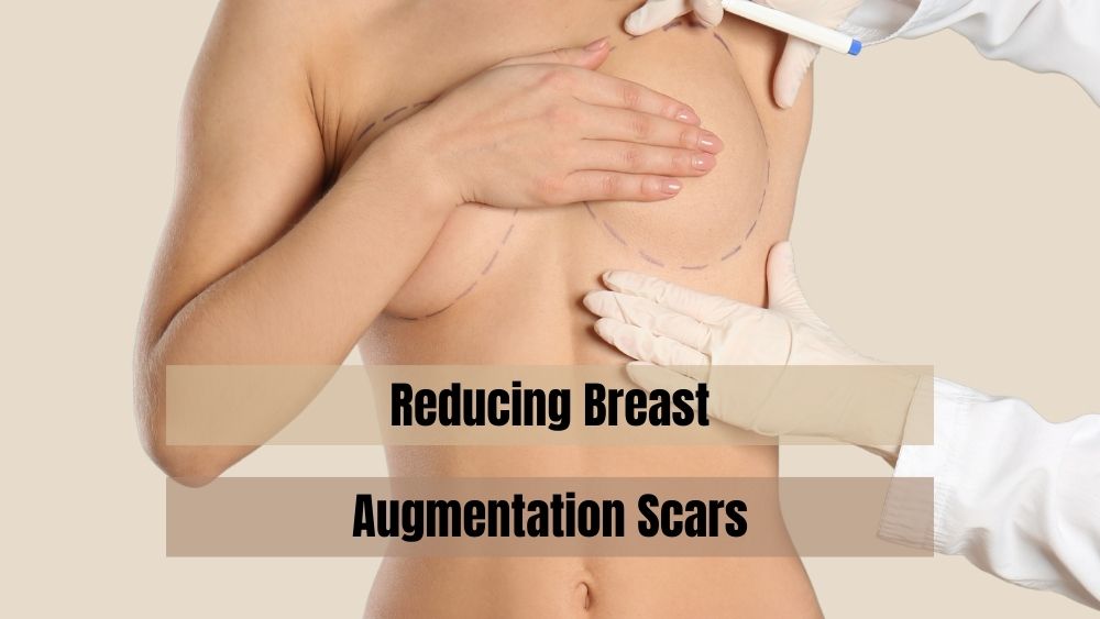 Reducing Breast Augmentation Scars