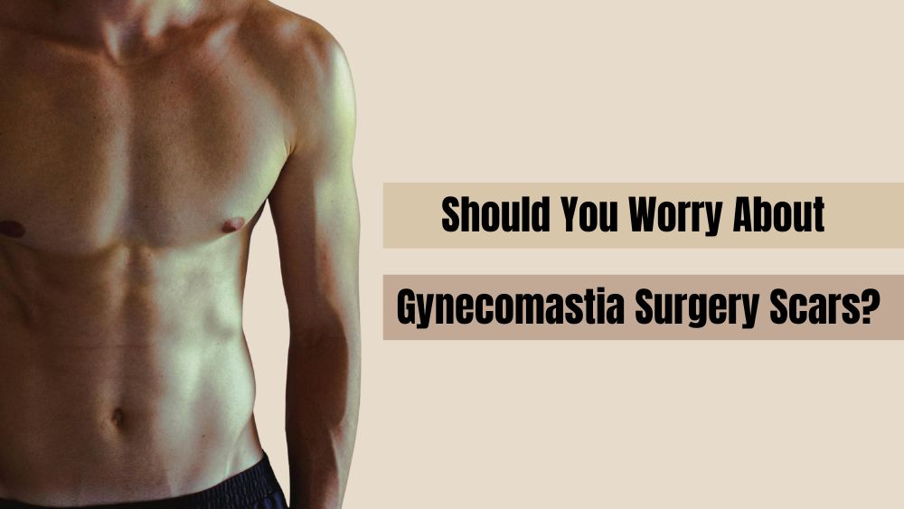 Should You Worry About Gynecomastia Surgery Scars