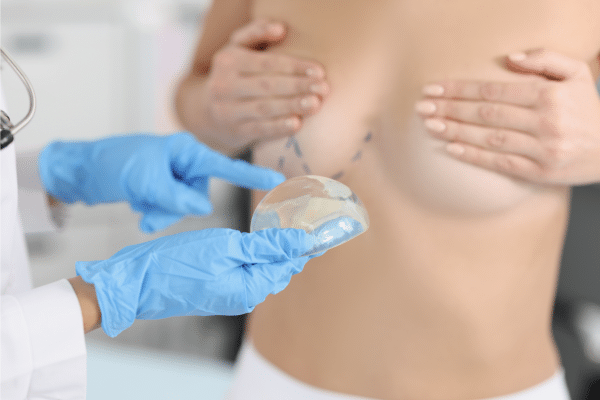 Submuscular Breast Implant Placement