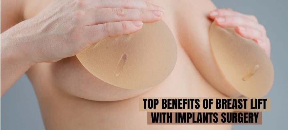 top benefits of Breast lift with Implants surgery