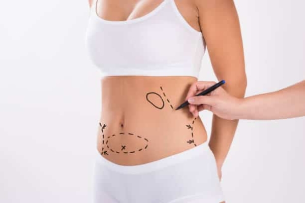 Tummy Tuck vs Liposuction Which is Best for Me
