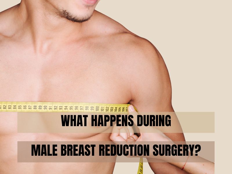 WHAT HAPPENS DURING MALE BREAST REDUCTION SURGERY