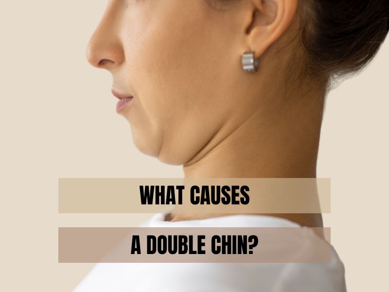 What Causes a Double Chin?