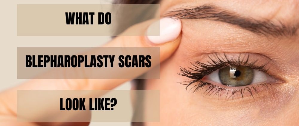 What Do Blepharoplasty Scars Look Like