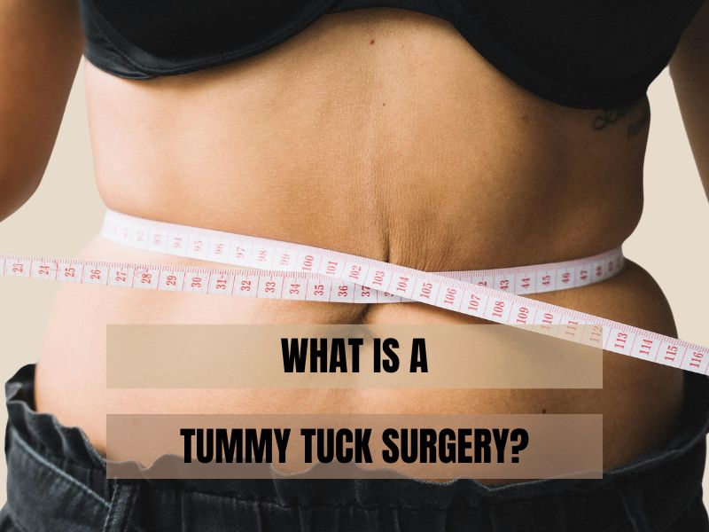 What Is a Tummy Tuck Surgery