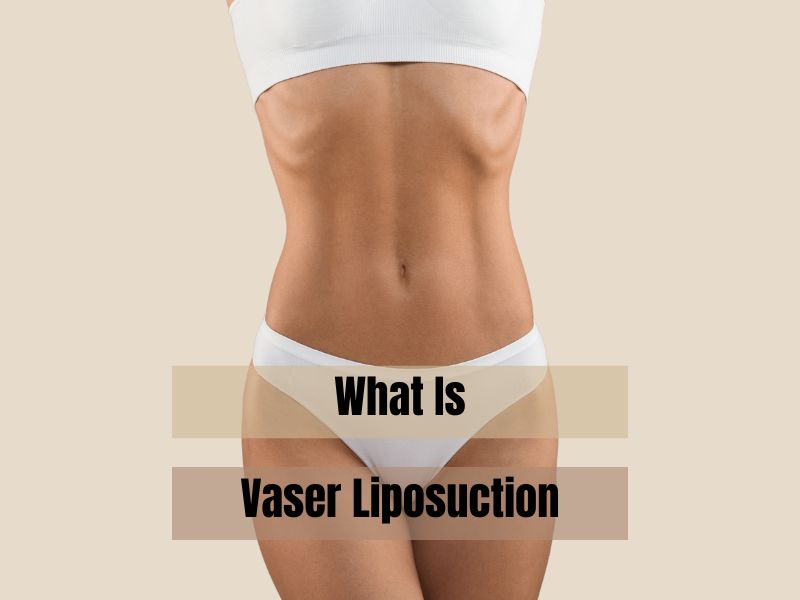 What Is Vaser Lipo