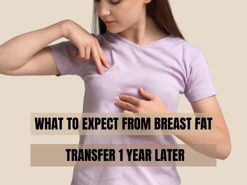 What to Expect From Breast Fat Transfer 1 Year Later
