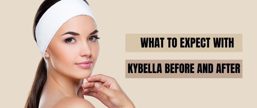 What to Expect With Kybella Before and After