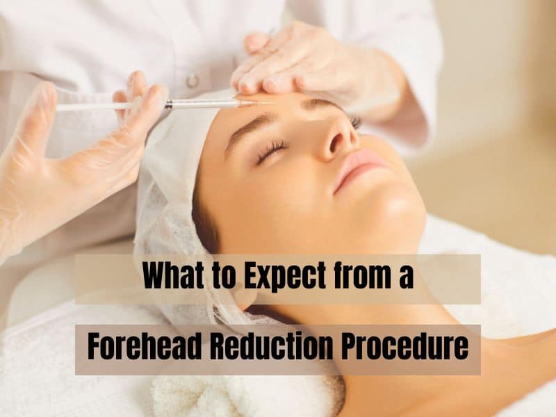 What to Expect from a Forehead Reduction Procedure
