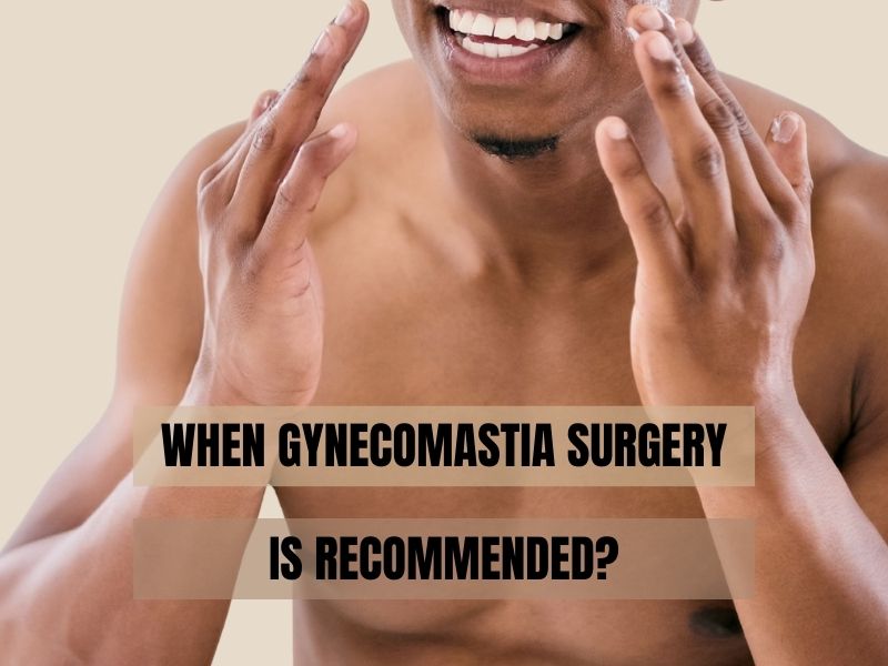 When Gynecomastia Surgery Is Recommended