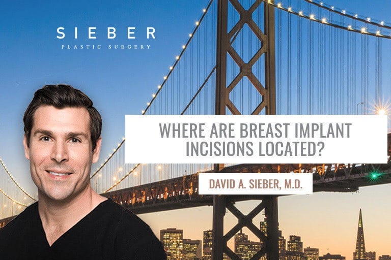 Where Are Breast Implant Incisions Located