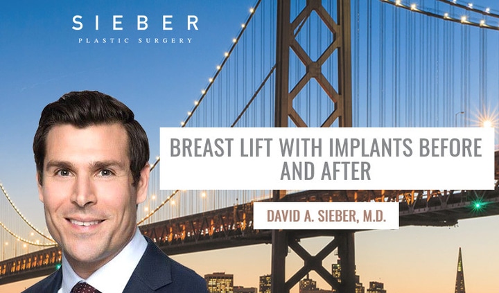 Breast Lift With Implants Before And After