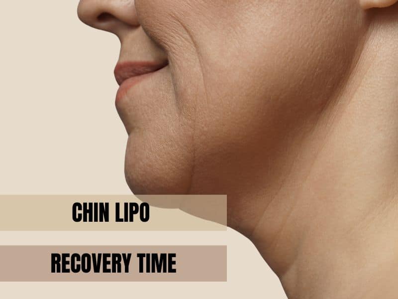 chin lipo recovery time